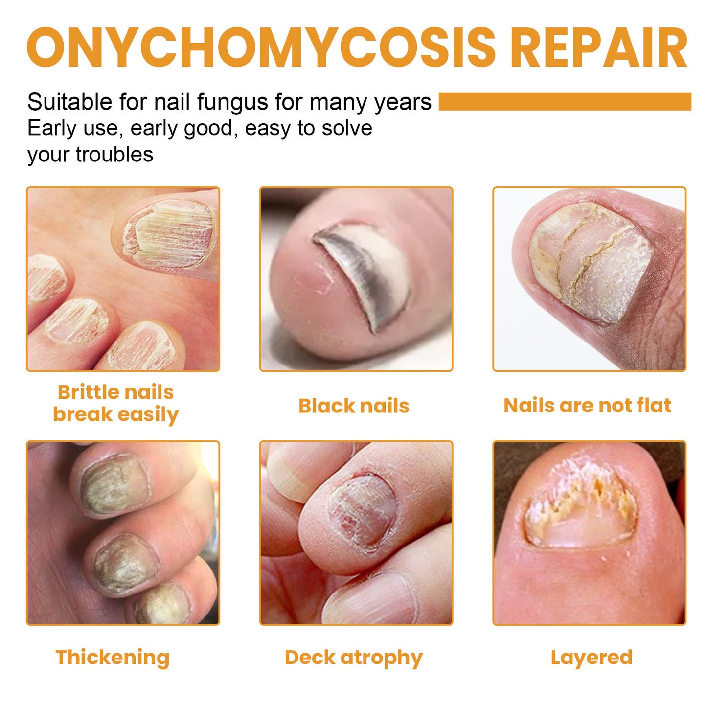 32 Pcs Ingrown Nail Repair Patch